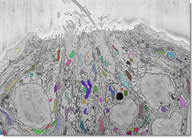 2D instance segmentation example