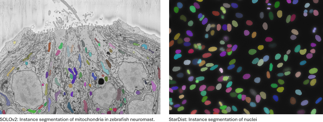 Examples of 2D instance segmentation